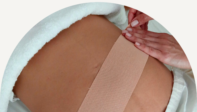 Postpartum Kinesio Taping