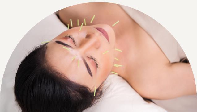 Facial Cosmetic Acupuncture
